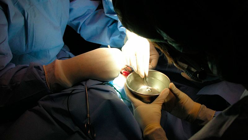 Sanidad convoca a científicos y pacientes tras las revelaciones sobre defectos en implantes médicos