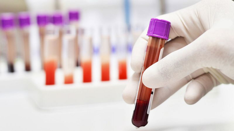 Física y nanotecnología se unen para detectar precozmente el cáncer en muestras de sangre