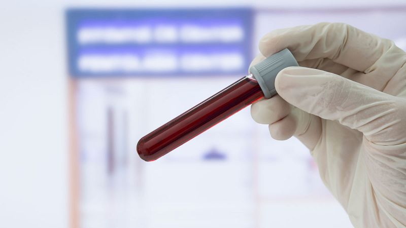 El control del colesterol tras un infarto mejora en un 40% con seguimiento a distancia