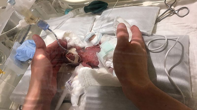 Sale del hospital el bebé prematuro más pequeño del mundo, que nació en Japón pesando 268 gramos