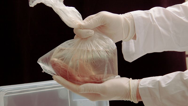 La donación de órganos aumenta un 11% en el primer trimestre de 2019