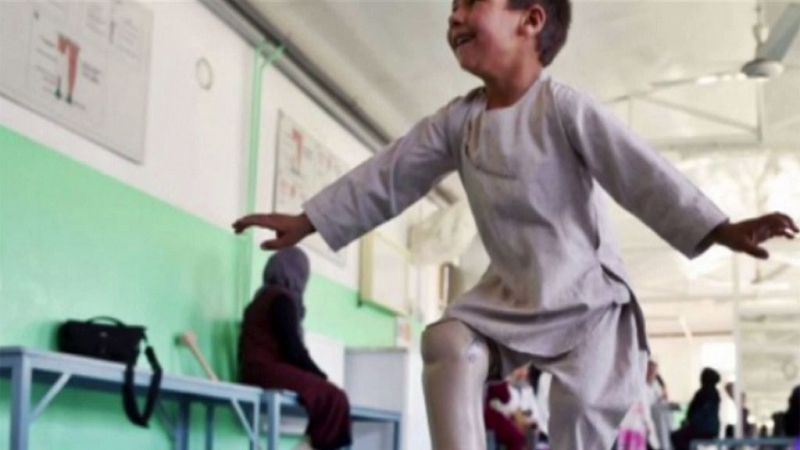 Ahmad, el niño que baila de felicidad tras recuperar su pierna
