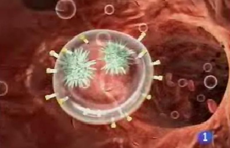 Consiguen que desaparezca el SIDA en un paciente con leucemia con la médula de un donante inmune