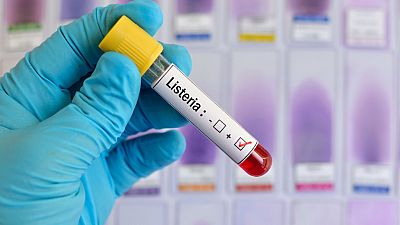 Listeriosis, alerta de seguridad alimentaria