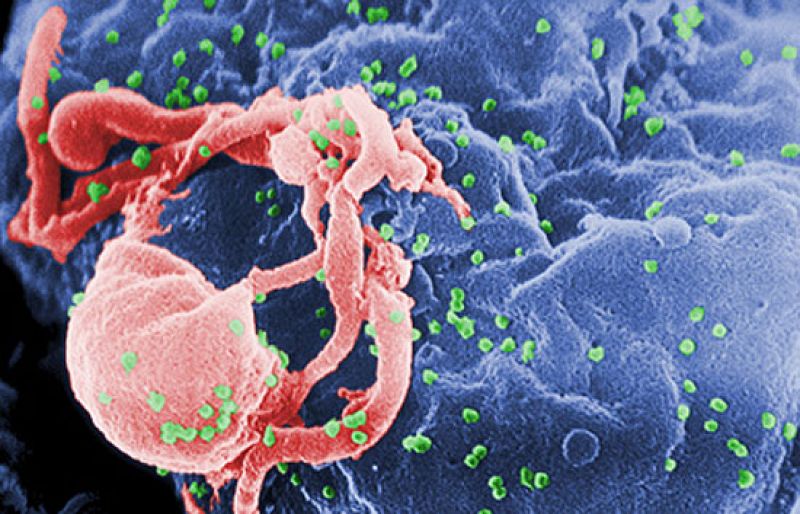 Dos hospitales ensayan a partir de enero la primera vacuna española contra el sida