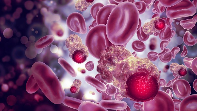 Desarrollan una nueva terapia con ultrasonidos que atacan sólo a las células cancerosas