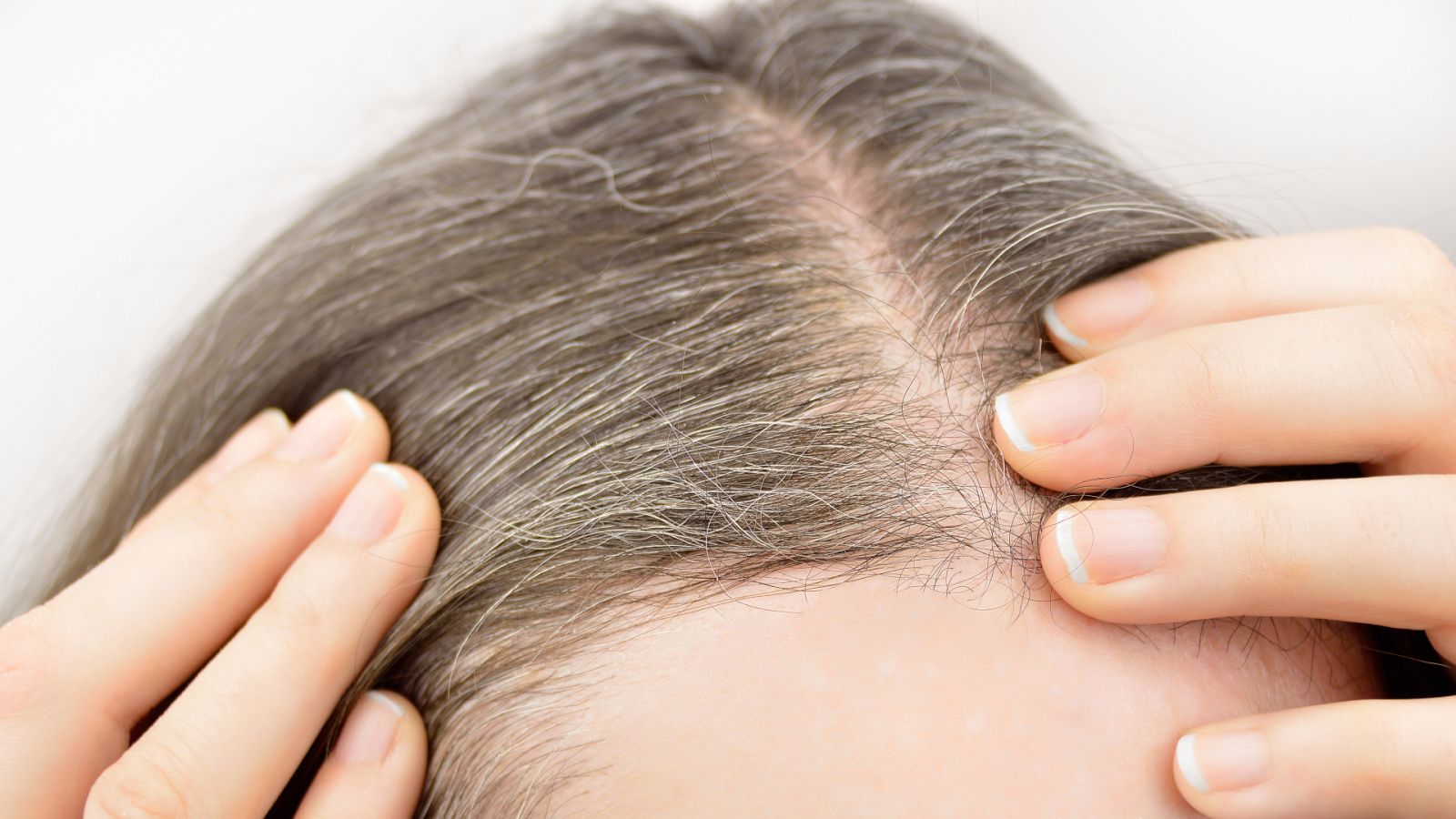 La Mañana - Investigaciones con ratones desvela cómo el estrés produce canas