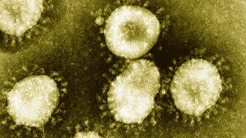 Edad, problemas de coagulación y sepsis: definidos los principales factores de riesgo del coronavirus