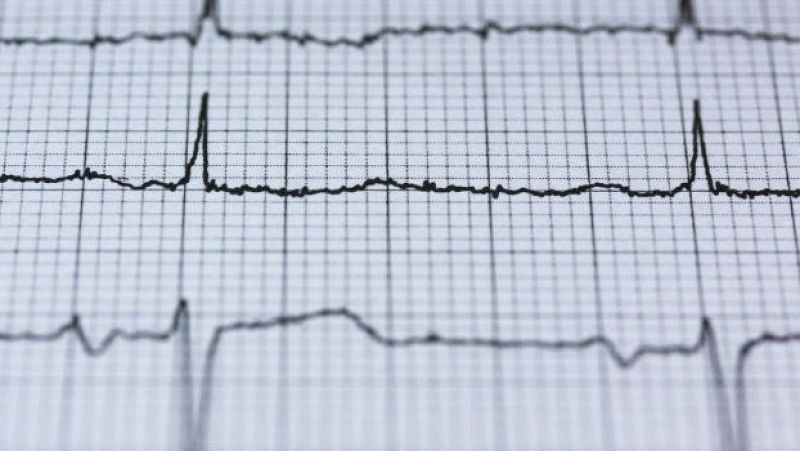 Los cardiólogos alertan de que pacientes con infartos "no acuden a urgencias por miedo a contagiarse"