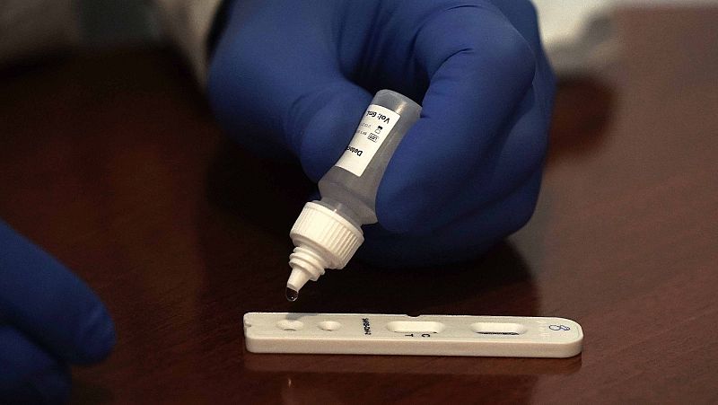 Las pruebas PCR del coronavirus se harán antes de las primeras 48 horas con síntomas