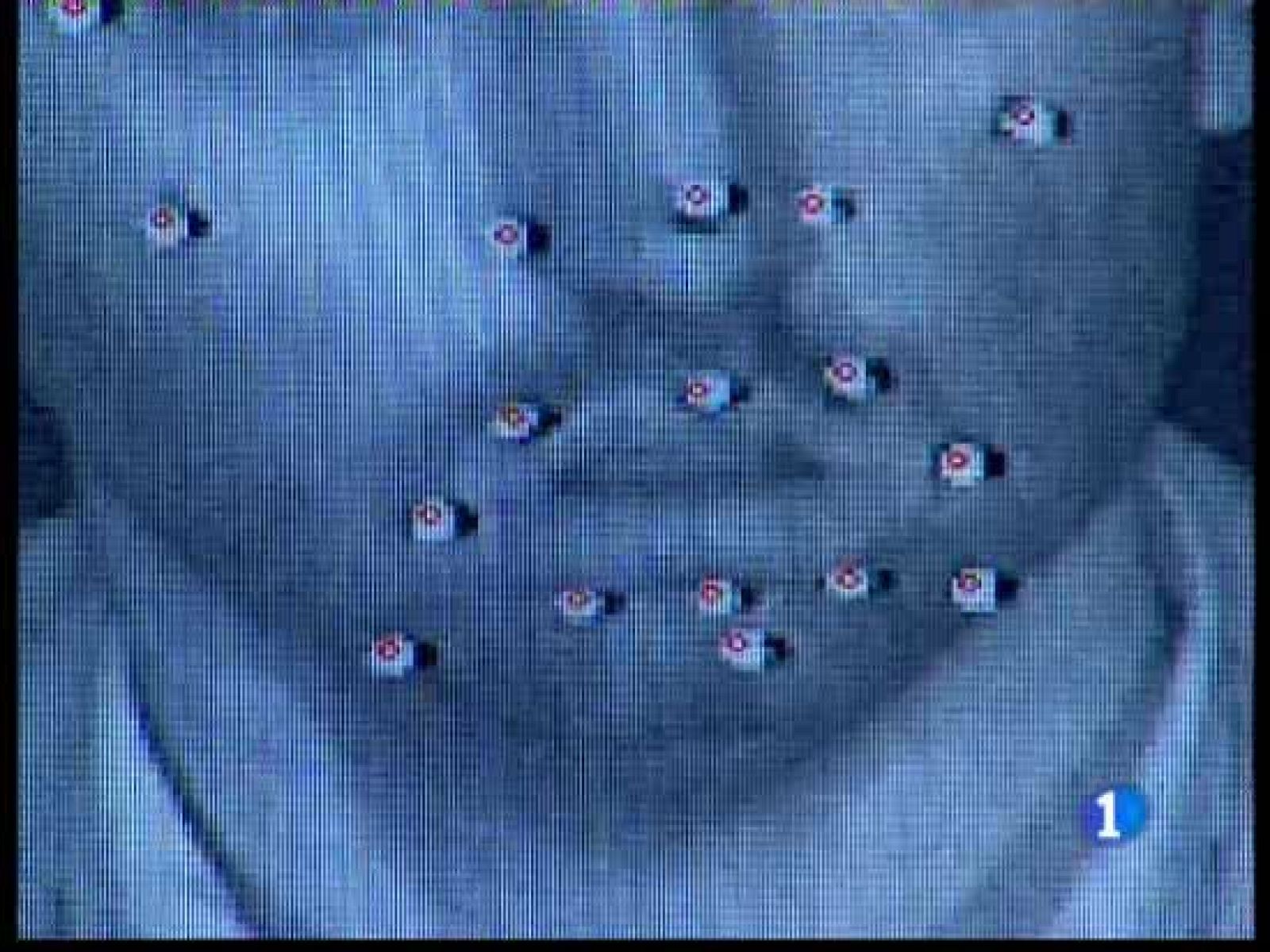 Un hombre ha vuelto a sonreír después de once años con parálisis facil por un tumor - Ciencia y tecnología en Rtve.es | Ver