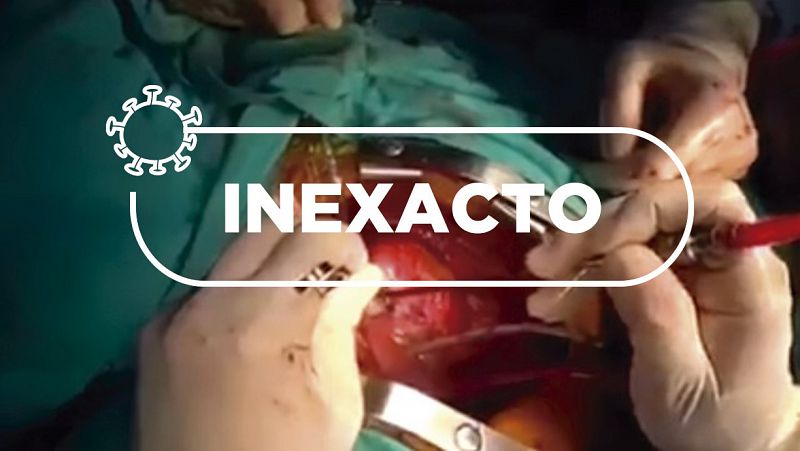 No, el vídeo de un cirujano operando a corazón abierto durante un terremoto en México no es de 2020, sino de 2017
