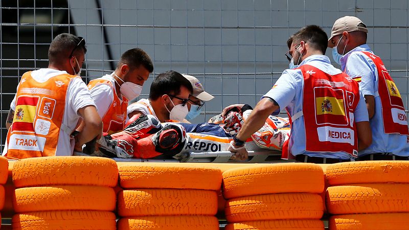 Marc Márquez será operado por una fractura en el húmero con posible afectación del nervio radial