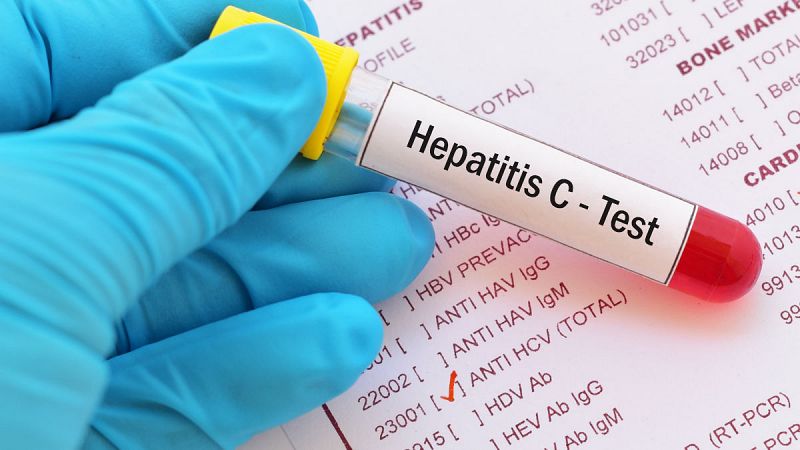 España podría eliminar la hepatitis C seis años antes de lo fijado por la OMS
