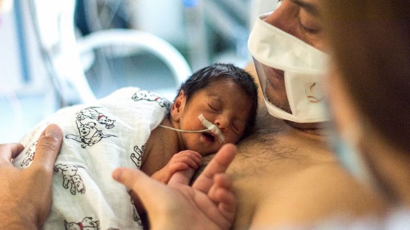 Mascarillas transparentes para que los bebés prematuros puedan ver la sonrisa de sus padres