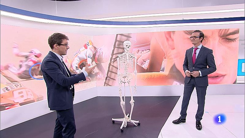 El doctor Villamor explica a TVE la intervención a Marc Márquez