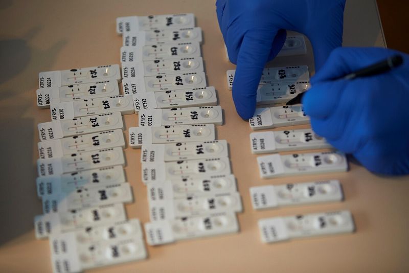 Los test rápidos de anticuerpos, camino de las farmacias bajo prescripción médica