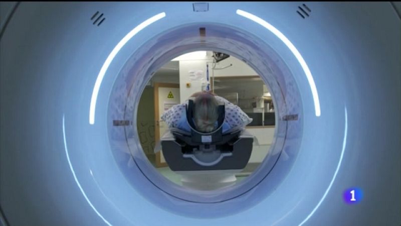 Centos de galegos cun cancro sen diagnosticar pola presión sanitaria