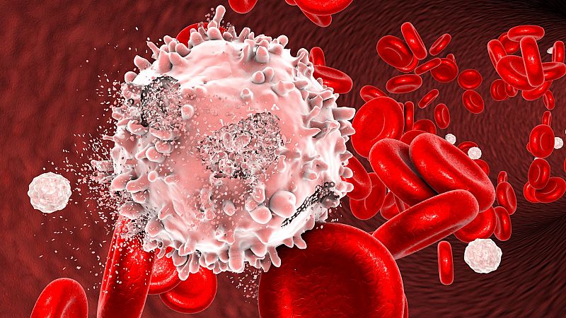 España autoriza el primer tratamiento inmunológico público contra la leucemia desarrollado en Europa
