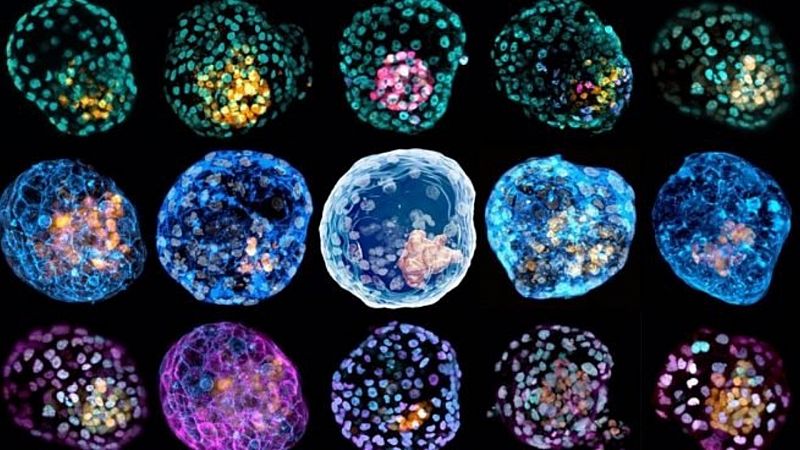 Científicos crean por primera vez un modelo de embrión temprano a partir de células de la piel