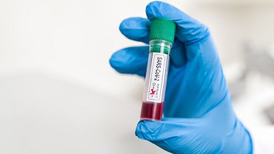 El laboratorio de JAL - El SARS-CoV-2 en sangre - 08/04/21 - Escuchar ahora