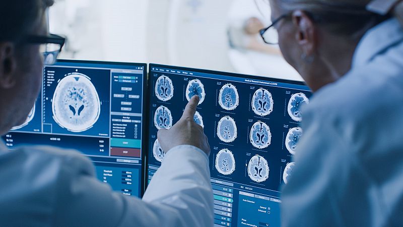 Un equipo de investigadores halla una terapia que mejoraría la supervivencia de pacientes con tumor cerebral