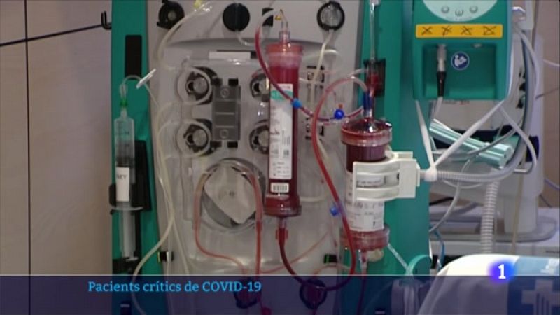 Vall d'Hebron assaja un filtre sanguini per a tractar pacients crítics de coronavirus