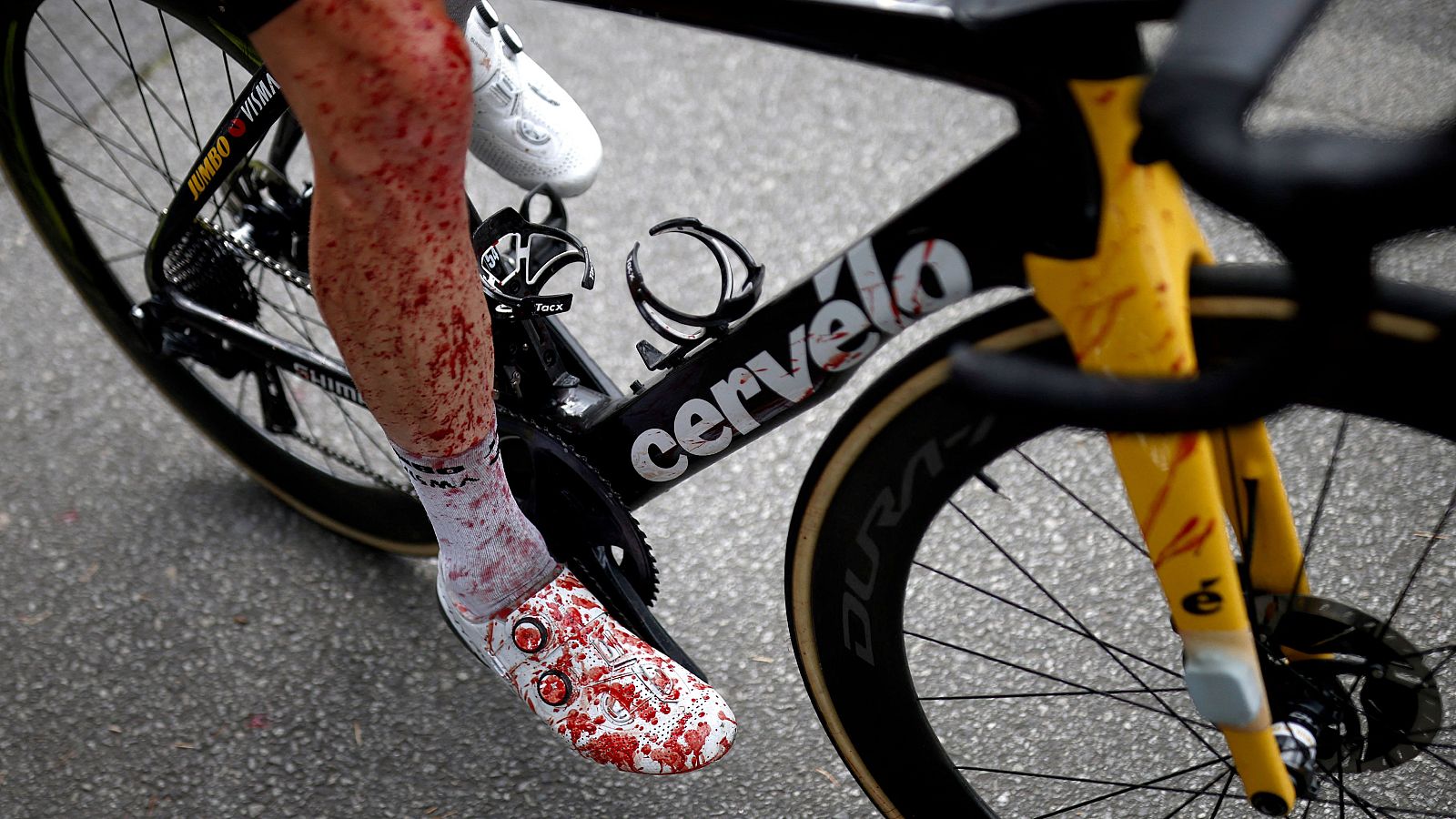 Tour 2021 | Pedro Delgado analiza las caídas que han protagonizado el arranque del Tour