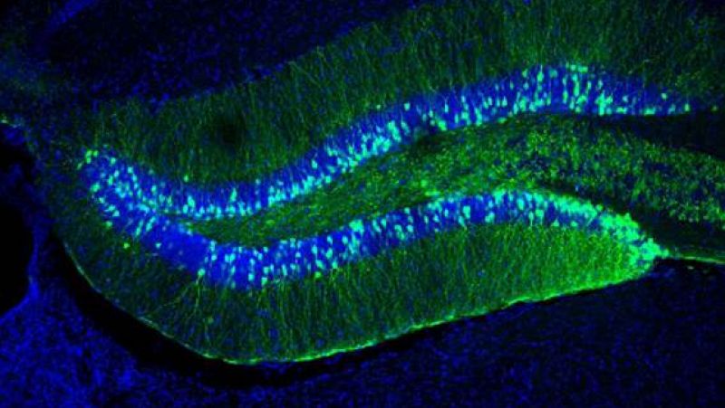 Investigadores del CSIC descubren un gen cuya alteración afecta al aprendizaje y la memoria