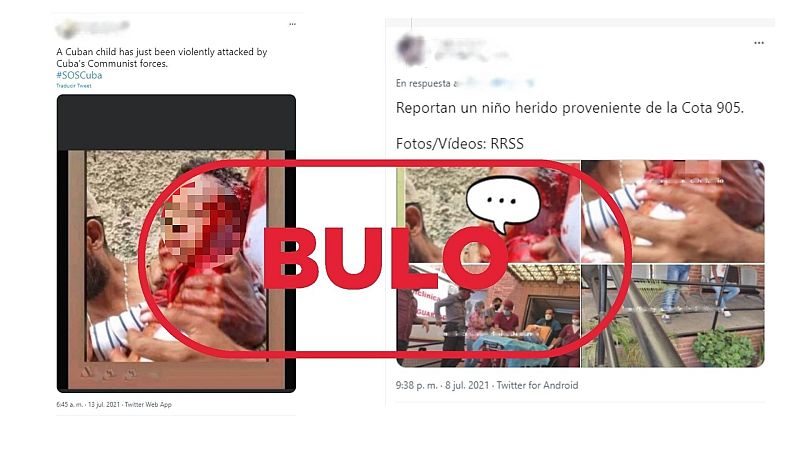 Esta foto de un niño herido de bala no es de las protestas en Cuba