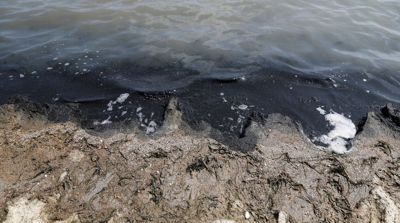 ¿Qué es la anoxia?