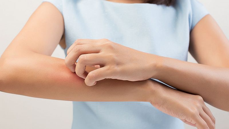 Consejos para mejorar la dermatitis atópica