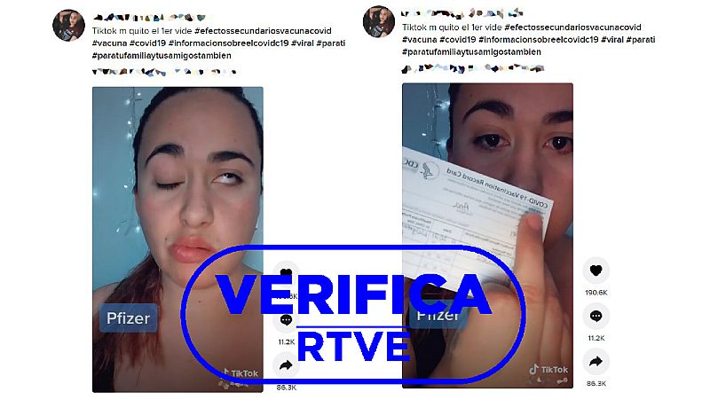 Parlisis facial por la vacuna: un efecto adverso posible pero poco frecuente y leve