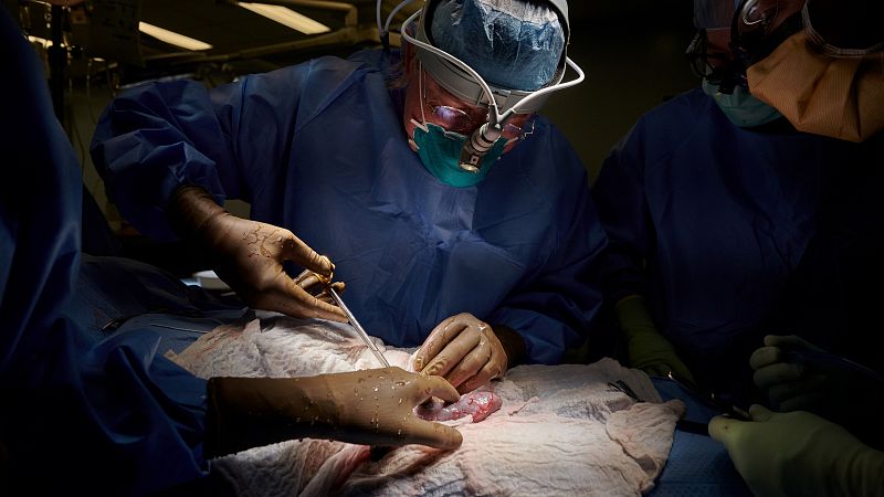 Logran trasplantar con éxito por primera vez un riñón de cerdo a una persona