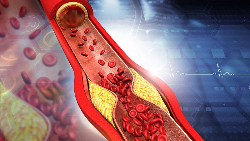 Cuatro maneras de atacar el colesterol malo