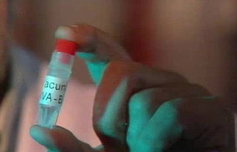España ensaya una vacuna contra el sida