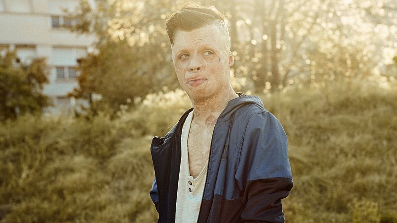 La música que alivió el dolor y devolvió la paz a Aleixo, "El niño de fuego"