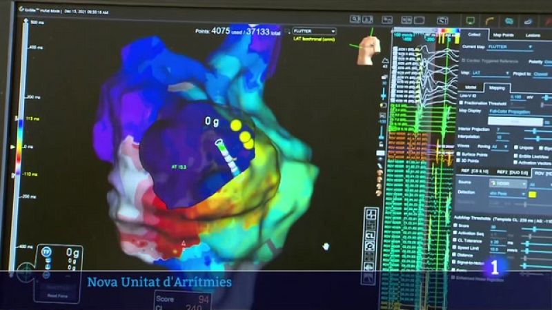 Vall d'Hebron estrena una Unitat d'Arrítmies amb tractaments innovadors