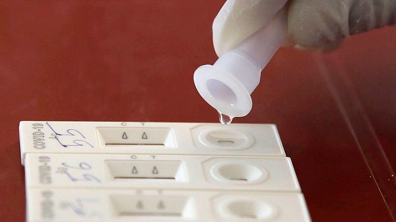 La Agencia del Medicamento pide la retirada de test de antígenos del laboratorio Genrui por falsos positivos