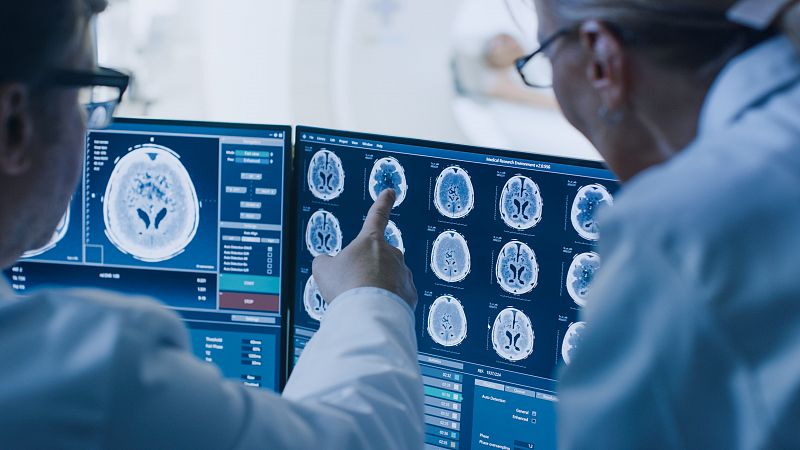 Encuentran la clave para mejorar la radioterapia en metástasis cerebral