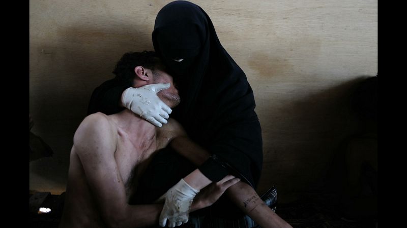'La Piedad' de Yemen: el amor en medio de la revolución