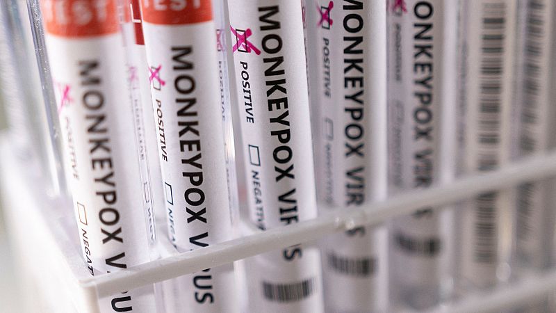 Canarias confirma el primer caso de viruela del mono fuera de Madrid y ya son 36 en total en España