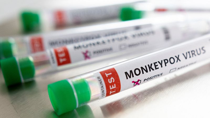 Sanidad eleva a 84 los casos de viruela del mono en España tras confirmar 25 nuevos positivos