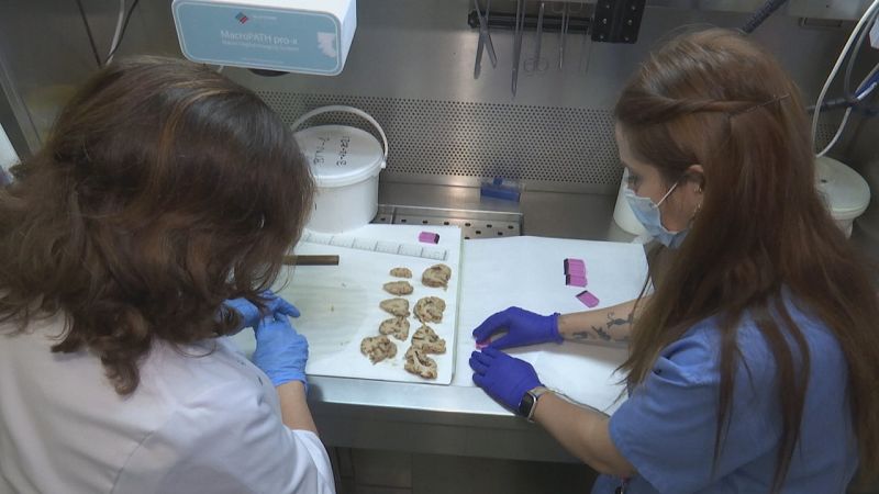 Llega el primer banco de tejido cerebral a Castilla-La Mancha