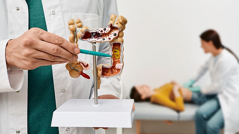 Identifican dos proteínas relacionadas con el cáncer de colón y la colitis ulcerosa