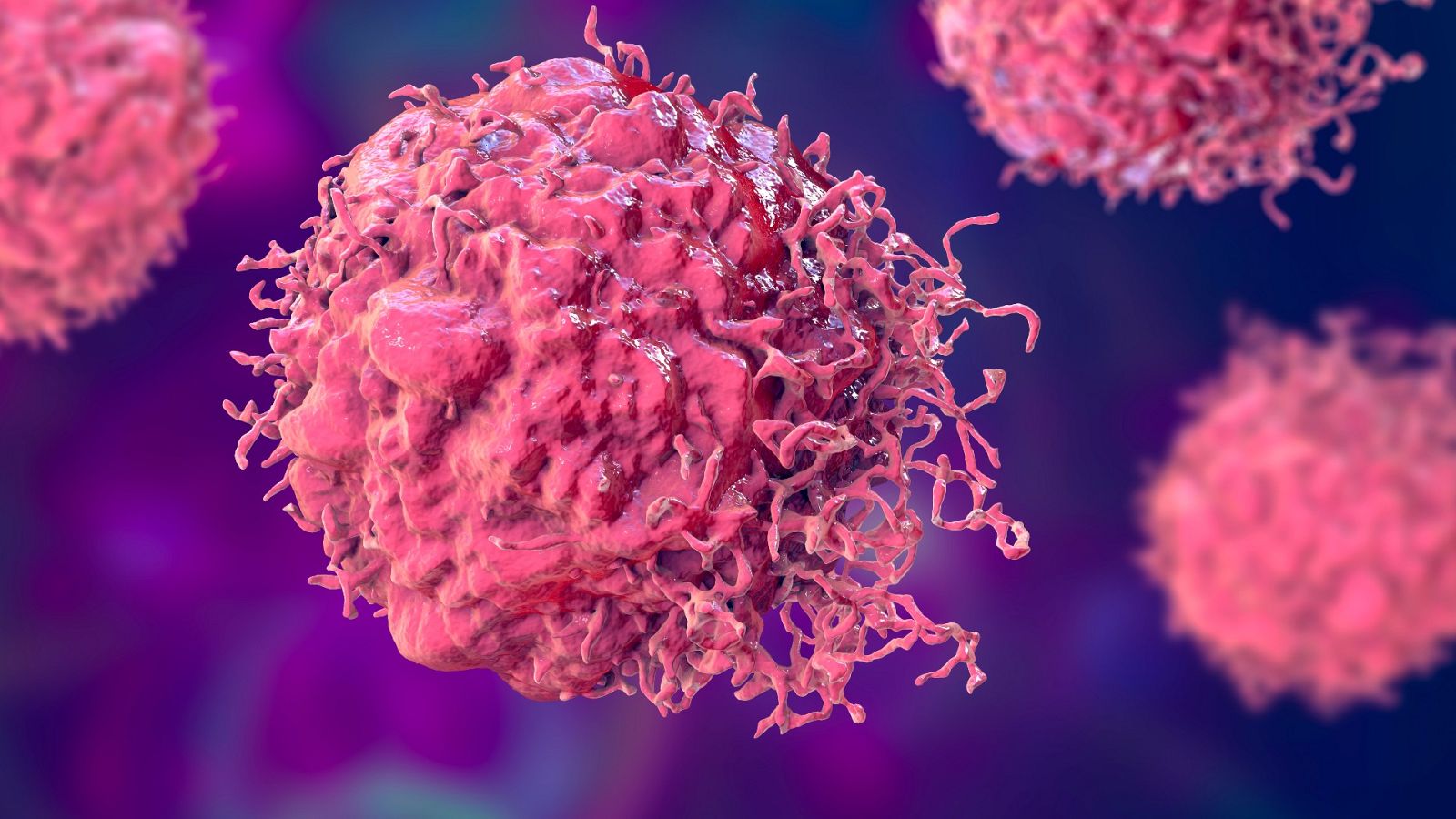 Casi la mitad de las muertes por cáncer están provocadas por factores de riesgo que se pueden prevenir