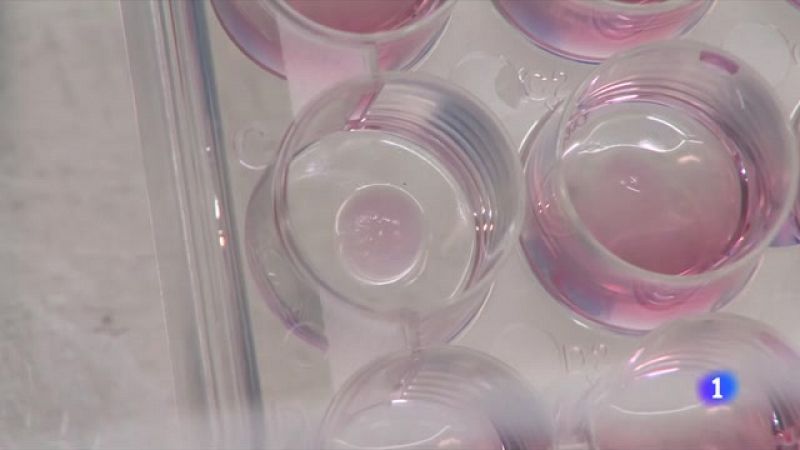 Nova eina per investigar el càncer de mama desenvolupada per l'Institut de Bioenginyeria de Catalunya