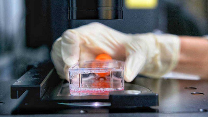 Bioimpresión 3D de tumores usando tejido de cerdo: la nueva herramienta contra el cáncer de mama