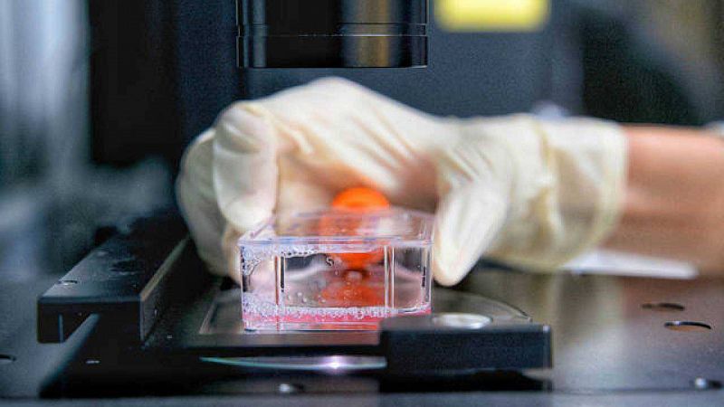Bioimpresión 3D de tumores usando tejido de cerdo: la nueva herramienta contra el cáncer de mama