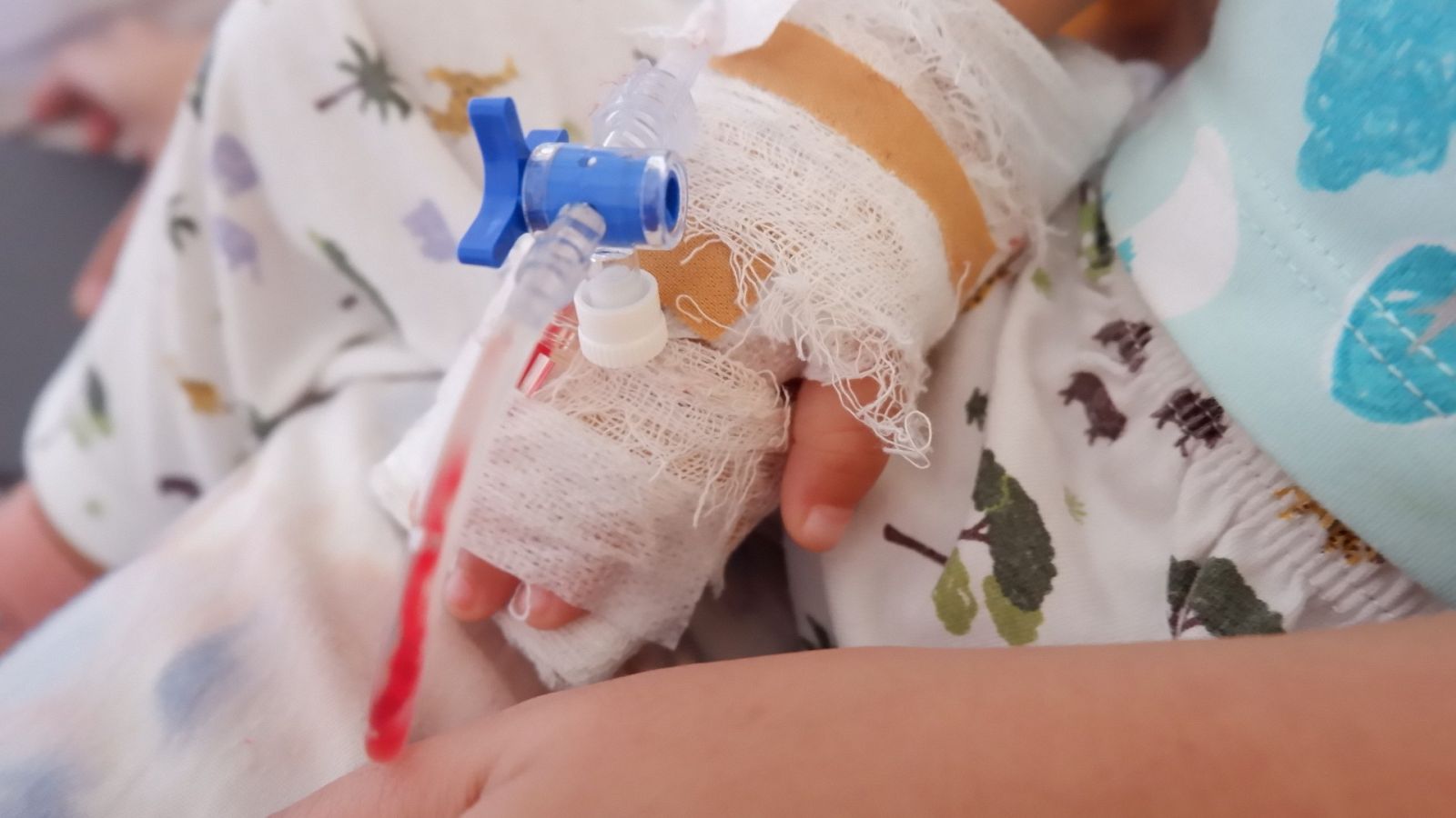 La ola de bronquiolitis en niños presiona las urgencias pediátricas mientras los hospitales buscan soluciones